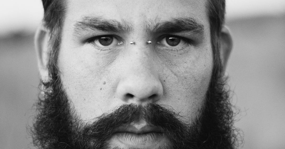 What'S The Difference Between Seborrheic Dermatitis And Psoriasis?