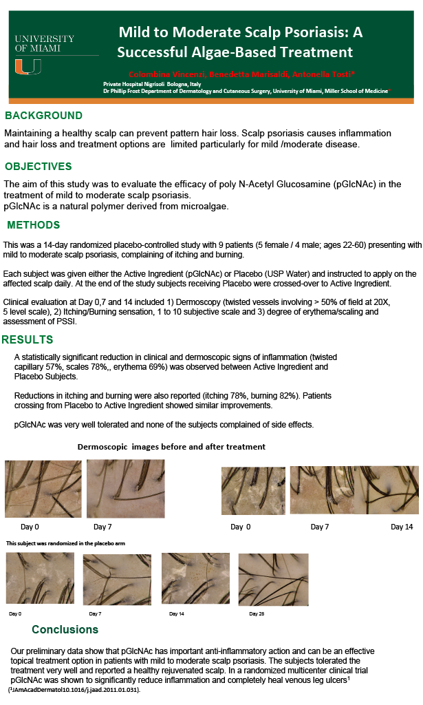 Mereltä's Treatment for Scalp Psoriasis | World Congress of Dermatology Milan Study