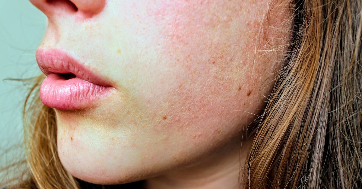 Can Scalp Inflammation Cause Headaches?