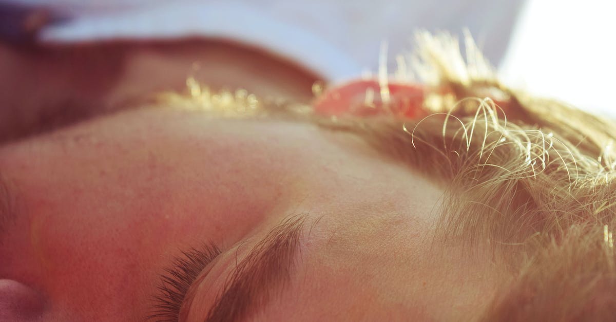 Can my skin be allergic to my hair?