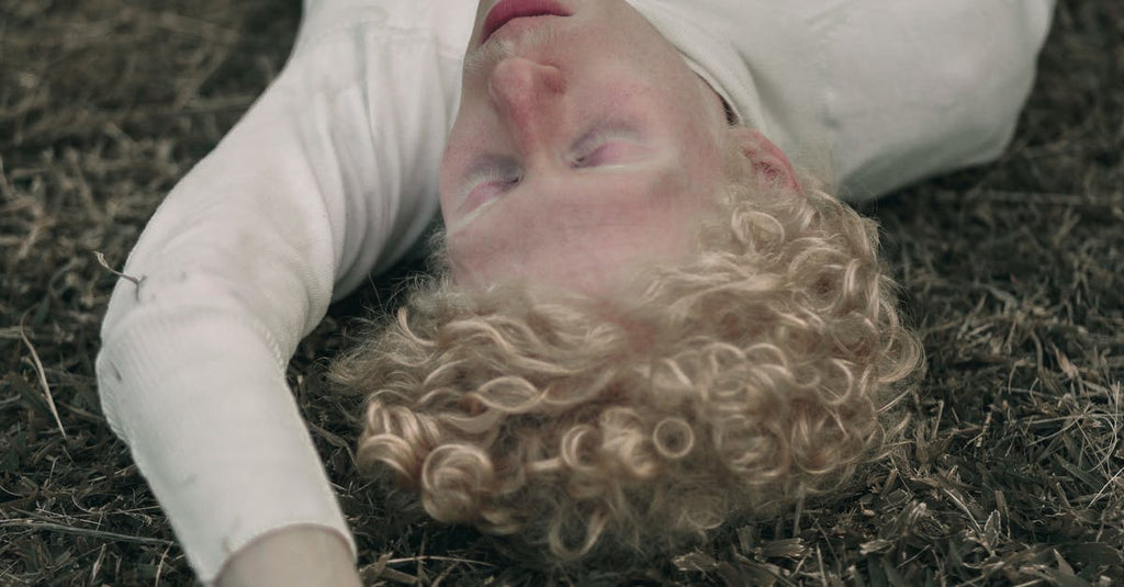 Is Seborrheic Dermatitis The Same As Eczema?