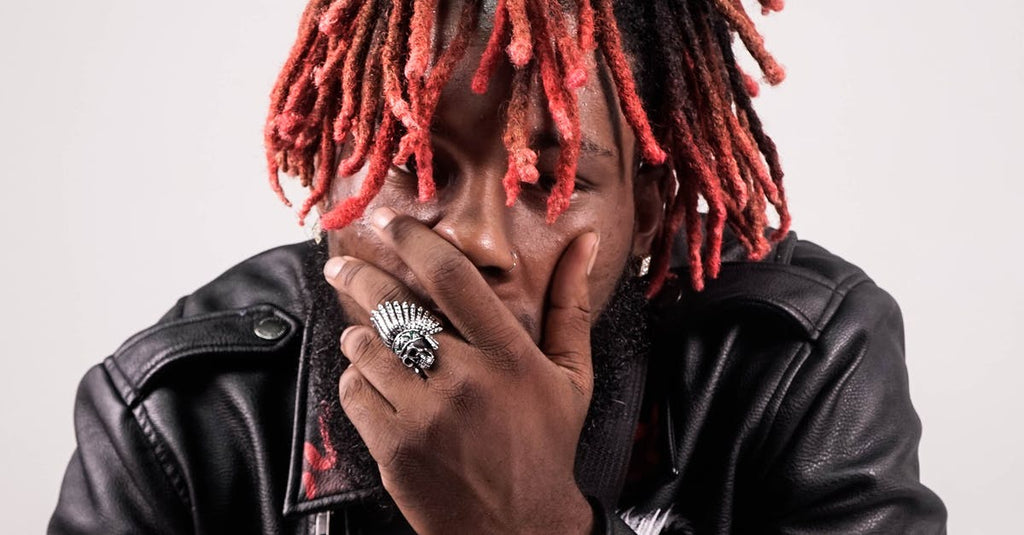 How To Know If I Have Seborrheic Dermatitis?