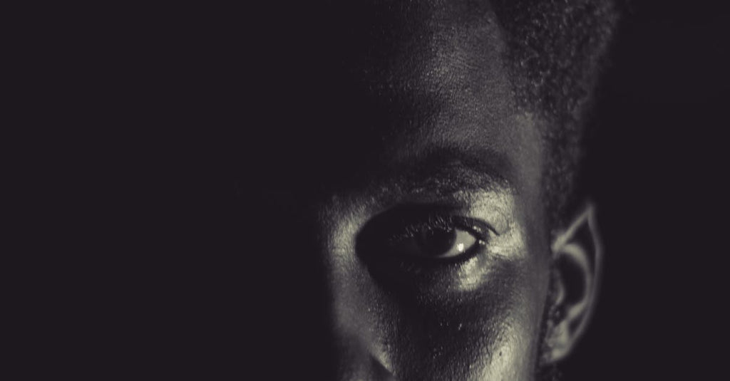 What Does Seborrheic Dermatitis Mean?