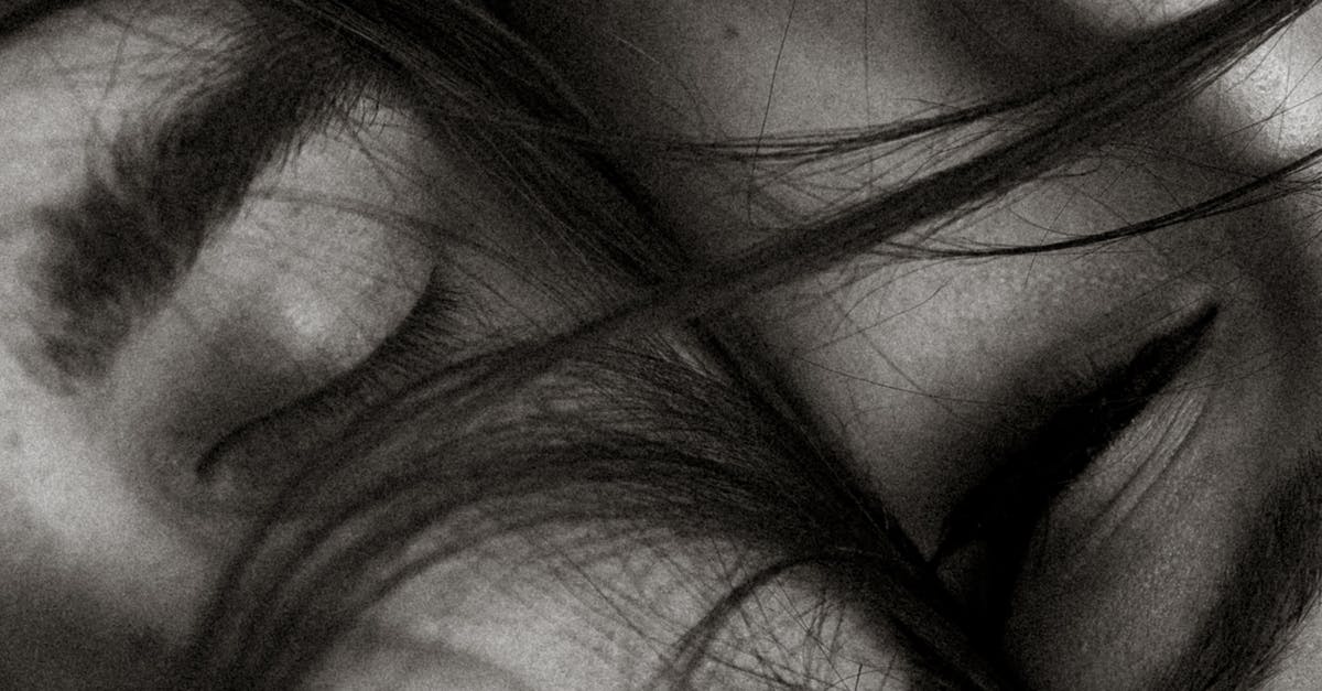 Does Scratching Scalp Psoriasis Make It Worse? 