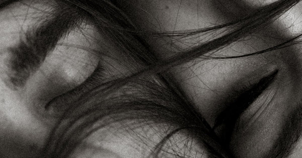 Does Scratching Scalp Psoriasis Make It Worse?