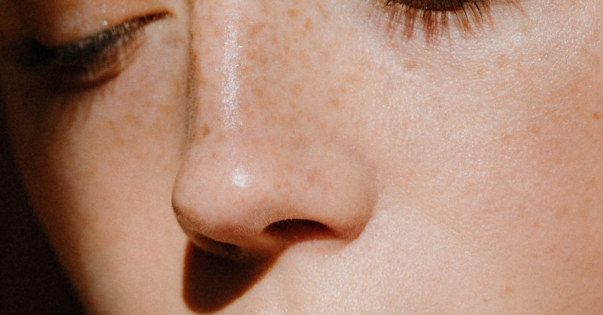 Can Scalp Inflammation Cause Hair Loss? Merelta