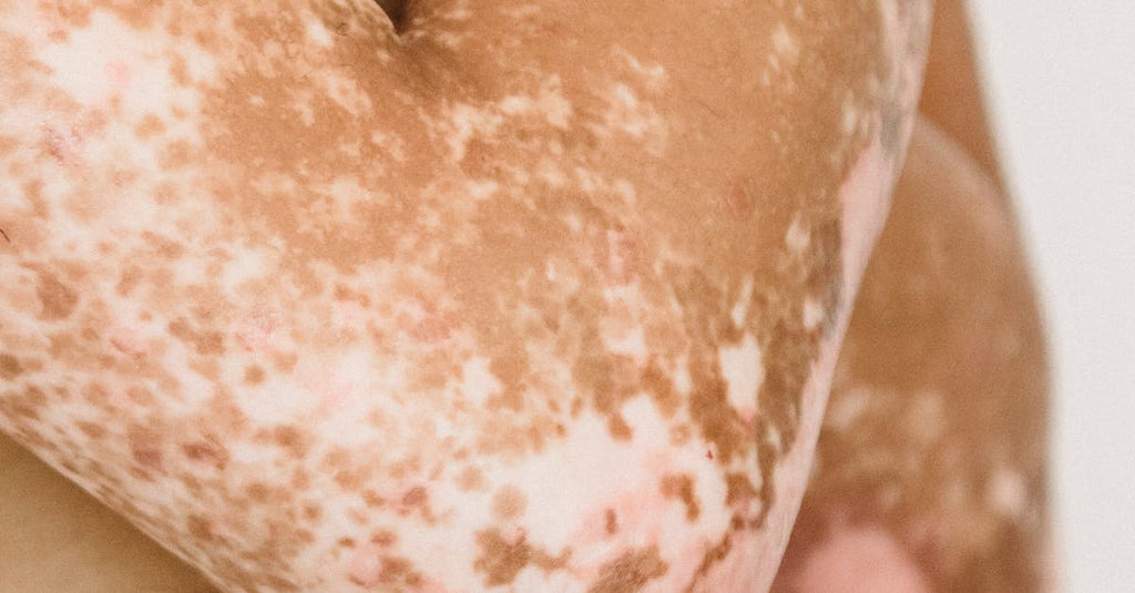 How do i get my scalp to stop itching?