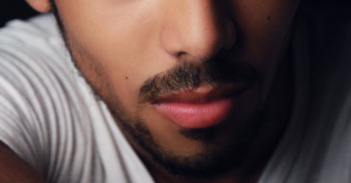 How do i get rid of dermatitis on my hairline?