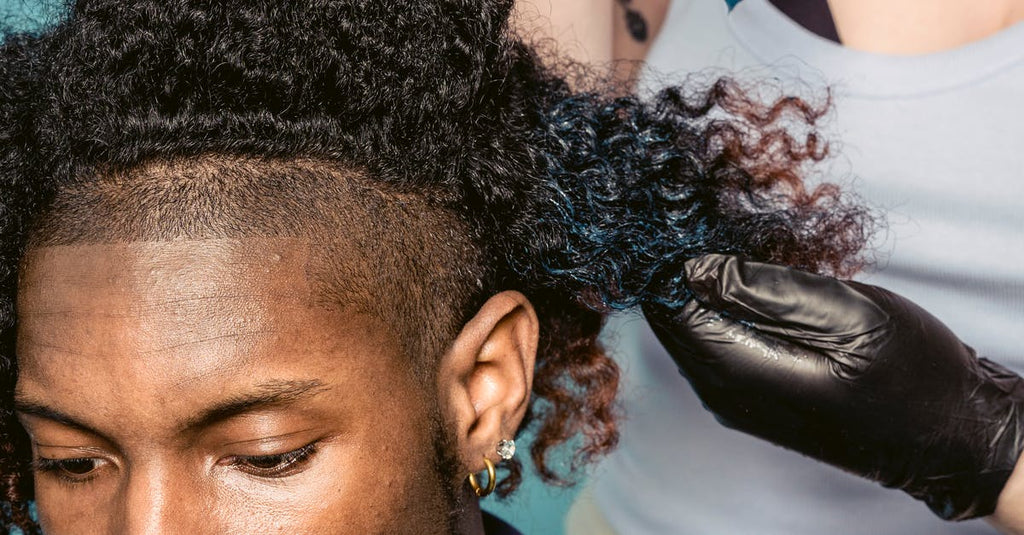 How To Make Seborrheic Dermatitis Go Away?