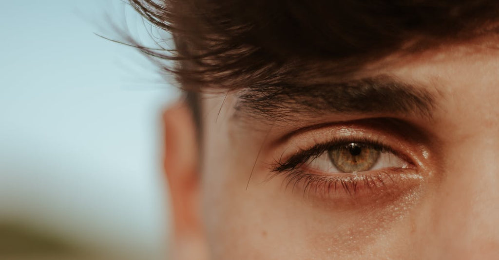 What Characterizes Seborrheic Dermatitis?