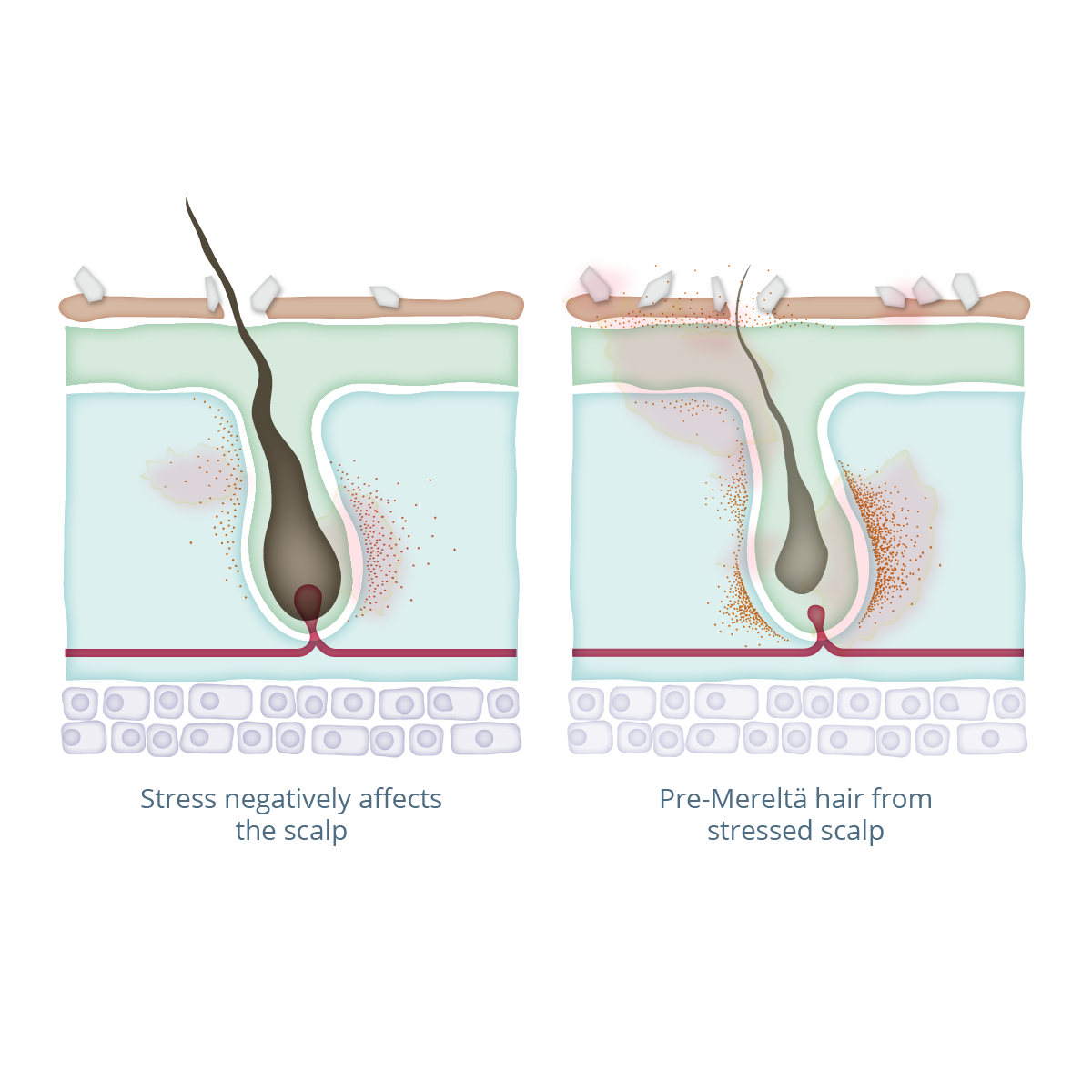 Merelta hair growth process and science